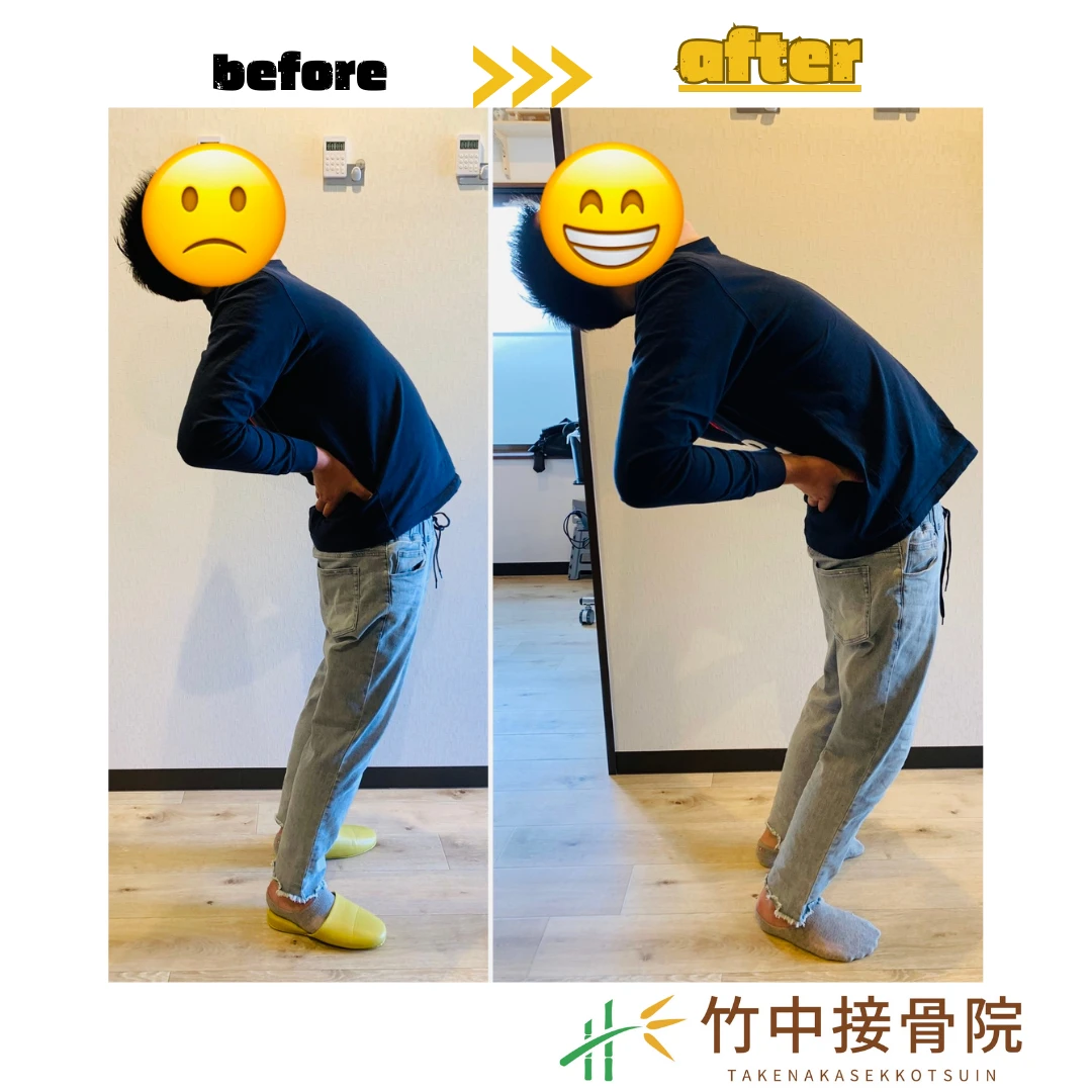 ハイボルテージ療法の注意点